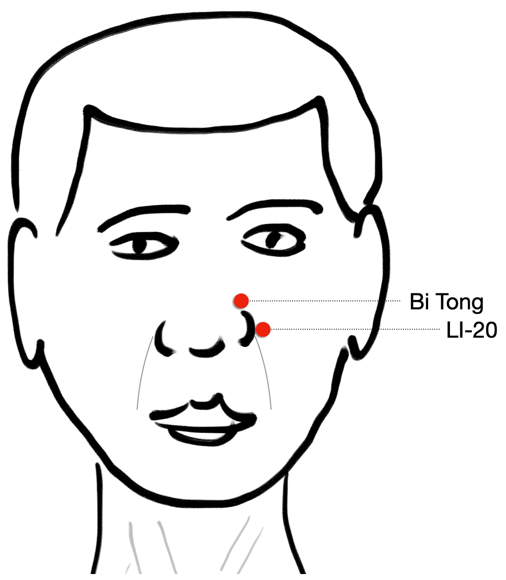 LI-20 and Bitong Acupuncture Points