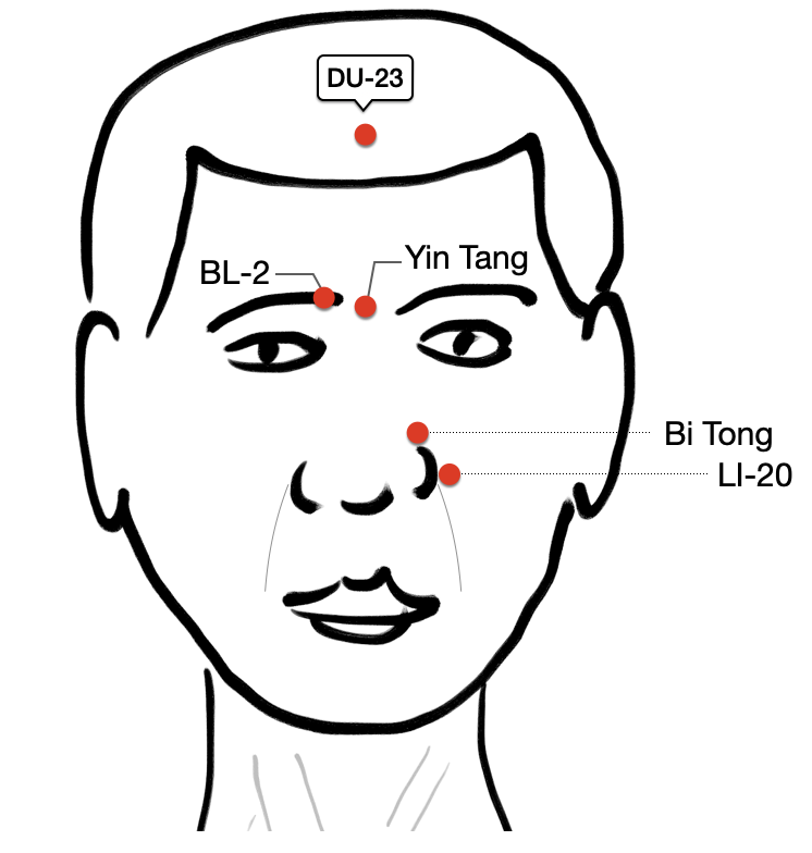 Acupuncture points on the face